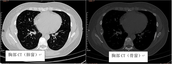 ��������⡹����ʰ��74 �� �߹��ʸ�˹ϸ����֯��֯����֢������